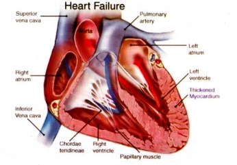 obat gagal jantung kongestif